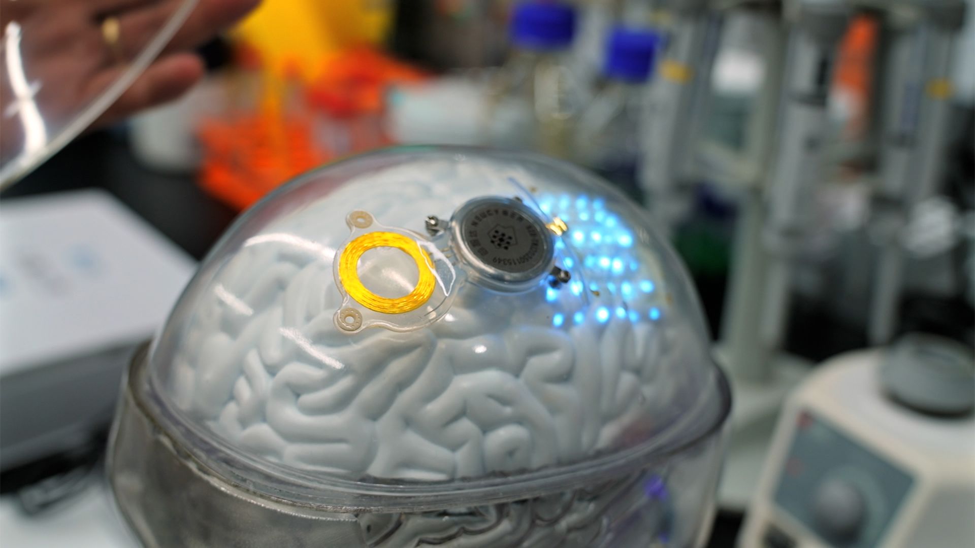 China’s Brain-Implant Tech Surges Ahead, Challenging Neuralink